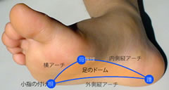 インソールの目的 インソールの目的