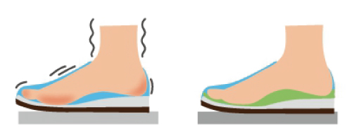 インソールとは？その①