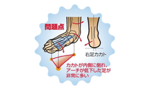 インソールとは？その①